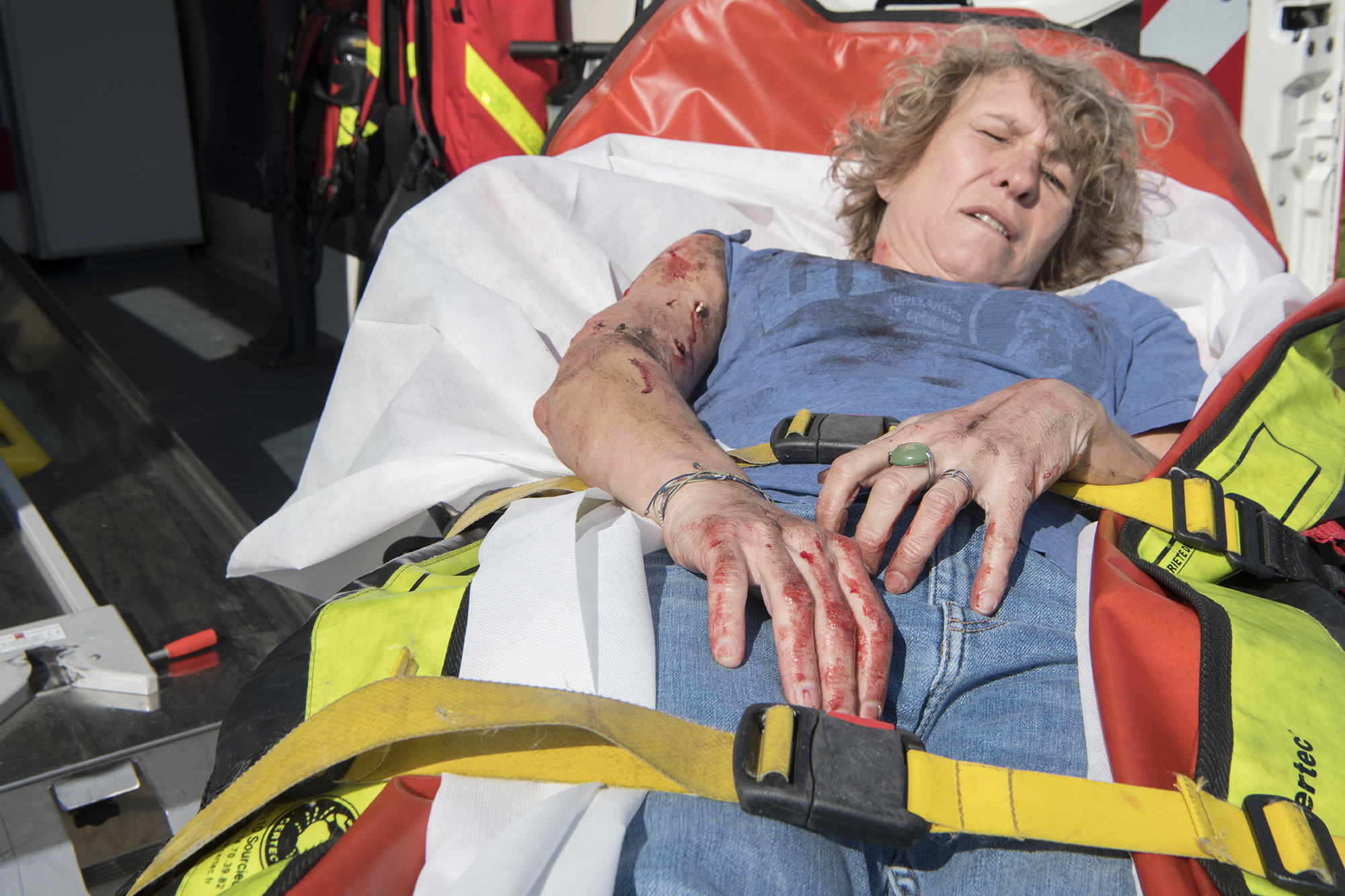 oms simulation 